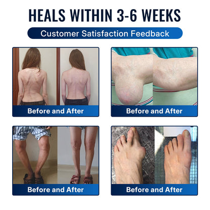 🛒 An additional 30% discount🎁Healrize® Bee Venom Joint Relief Cream 💞Fast-Acting Comfort for Stiff Knees, Hands, Back & Everyday Joint Discomfort.