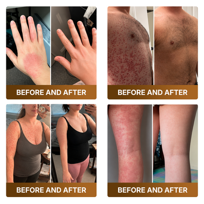 🛒 An additional 30% discount👑Made and Shipped from UK ✨🔥 DOCTIA® Botox & Bee Venom Advanced Recovery Cream—For Wrinkles, Sagging Skin, Skin Tags & Rough Bumps