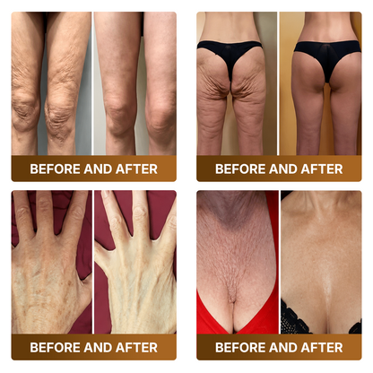 🛒 An additional 30% discount👑Made and Shipped from UK ✨🔥 DOCTIA® Botox & Bee Venom Advanced Recovery Cream—For Wrinkles, Sagging Skin, Skin Tags & Rough Bumps
