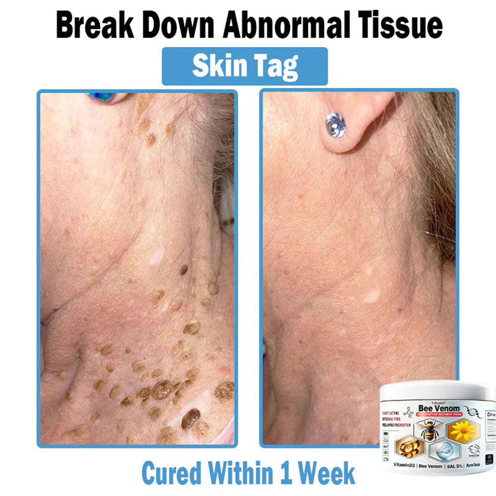 🔥1 Jar-Visible Skin Improvement