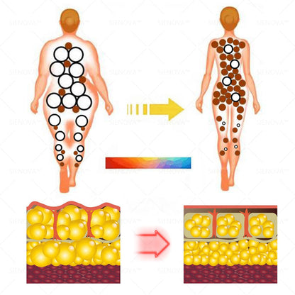 ✨ HEATWOLF® Ultrasonic RF Fat Reduction, Lymphatic Detox & Skin-Tightening Body Care Device——Wearable Care for Fat Reduction, Lymphatic Drainage, Inflammation Relief, Skin Tightening & Muscle Comfor（美国）