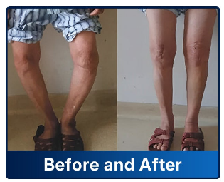 🛒 An additional 30% discount🎁Healrize® Bee Venom Joint Relief Cream 💞Fast-Acting Comfort for Stiff Knees, Hands, Back & Everyday Joint Discomfort.