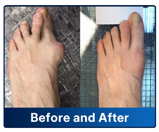 ✨Foot & Ankle Pain — Complete Solution
